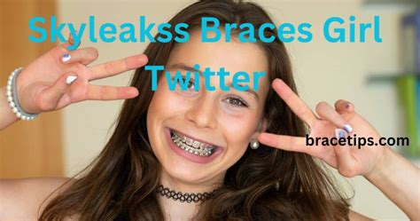 skyleakss braces girl|Girls Braces